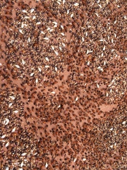 Syntermes molestus