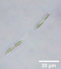 Elakatothrix