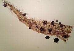 Bryomyces microcarpus rhacomitri