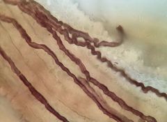 Bryomyces microcarpus rhacomitri