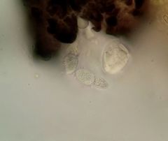 Bryomyces microcarpus rhacomitri