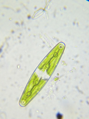 Closterium navicula var. crassum