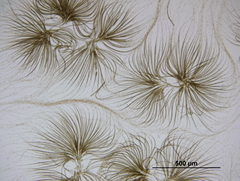 Gloeotrichia echinulata