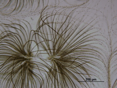 Gloeotrichia echinulata