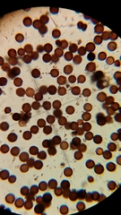 Elaphomyces muricatus