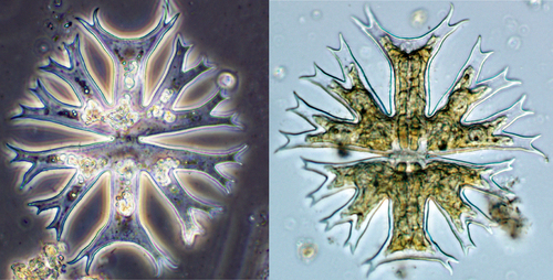 Micrasterias radians