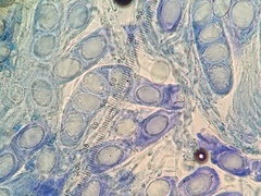 Hydnotrya variiformis