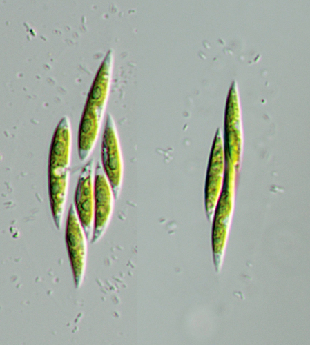 Cylindrocapsaceae