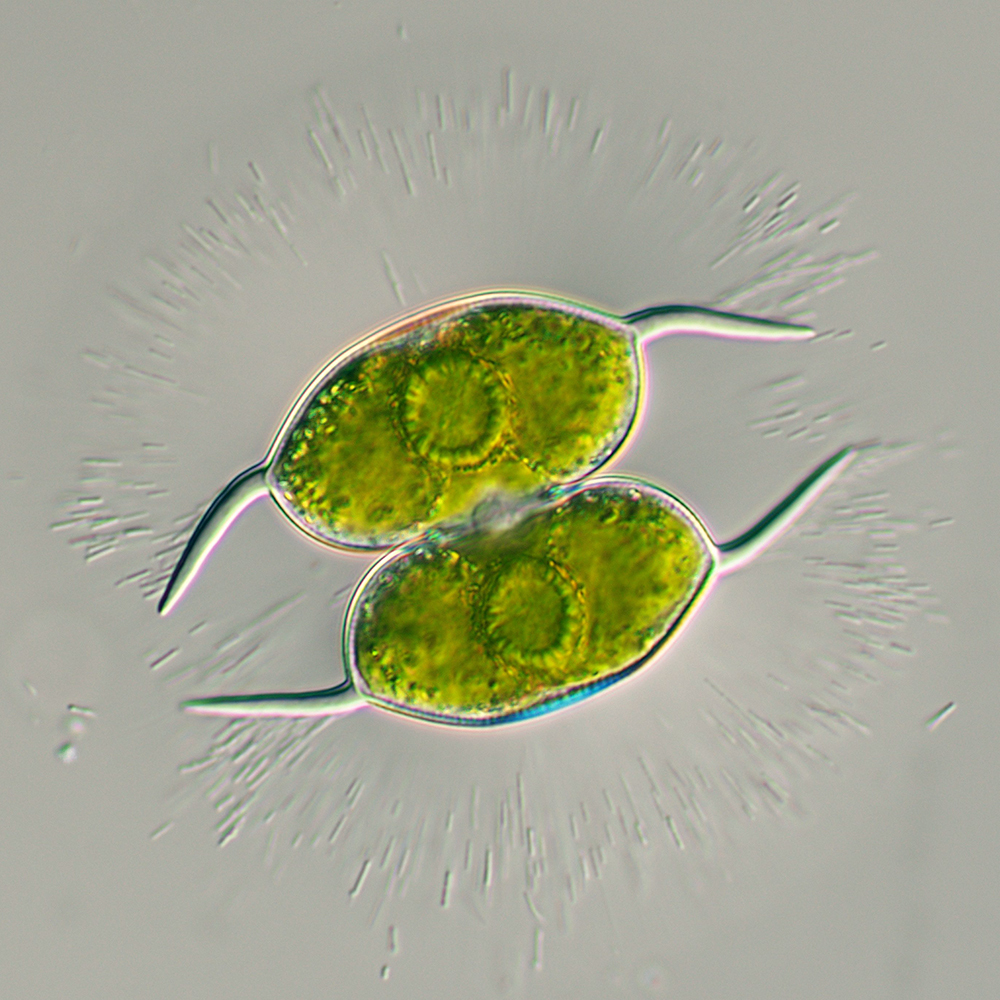 Staurodesmus convergens