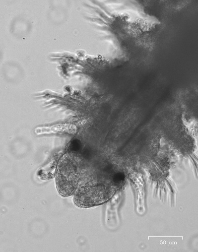 Genus Sphaerosyllis · iNaturalist