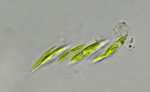 Elakatothrix gelatinosa