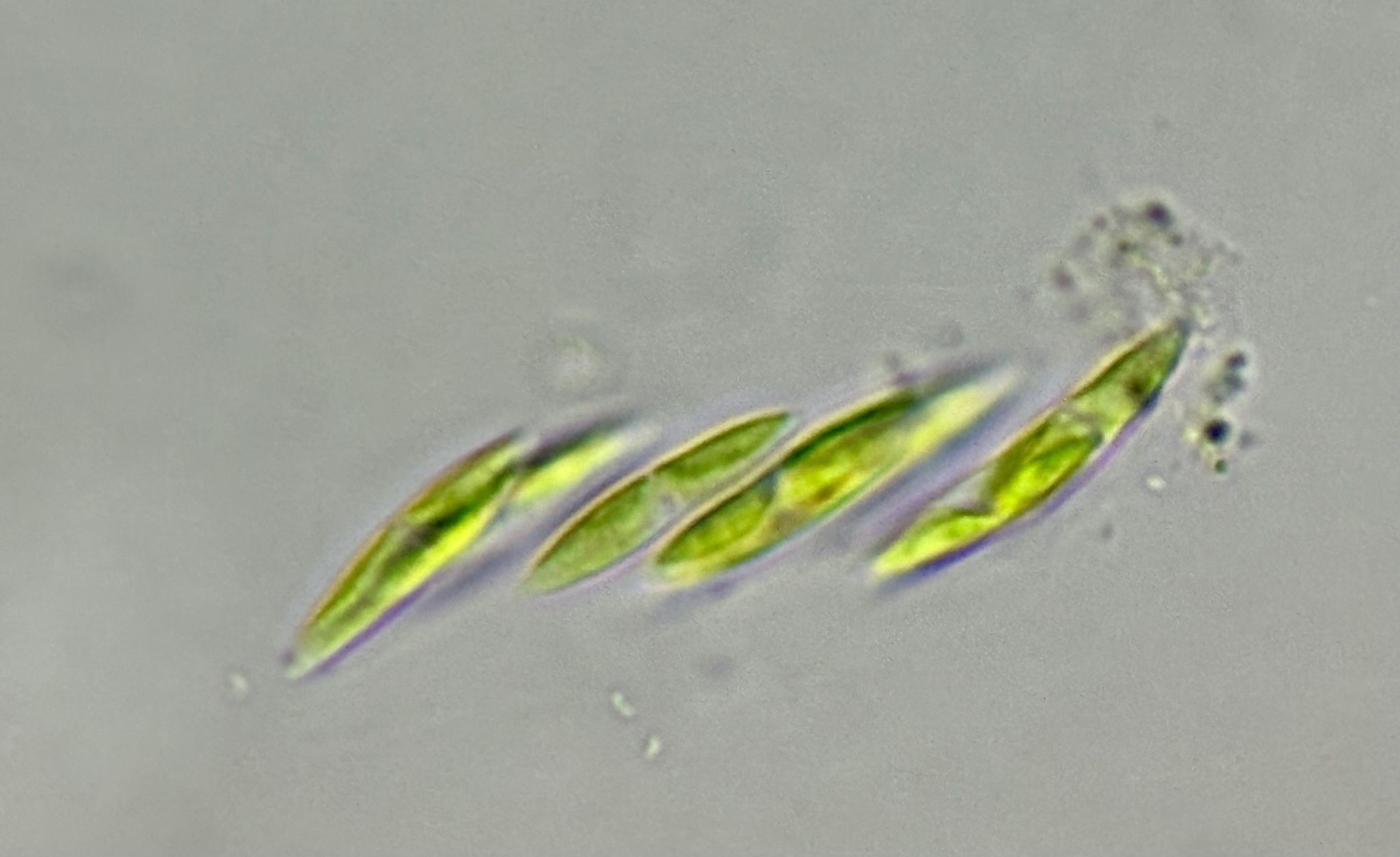 Elakatothrix gelatinosa