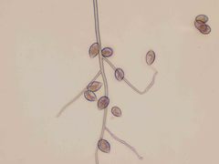 Phytophthora infestans