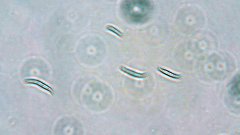 Neocosmospora solani