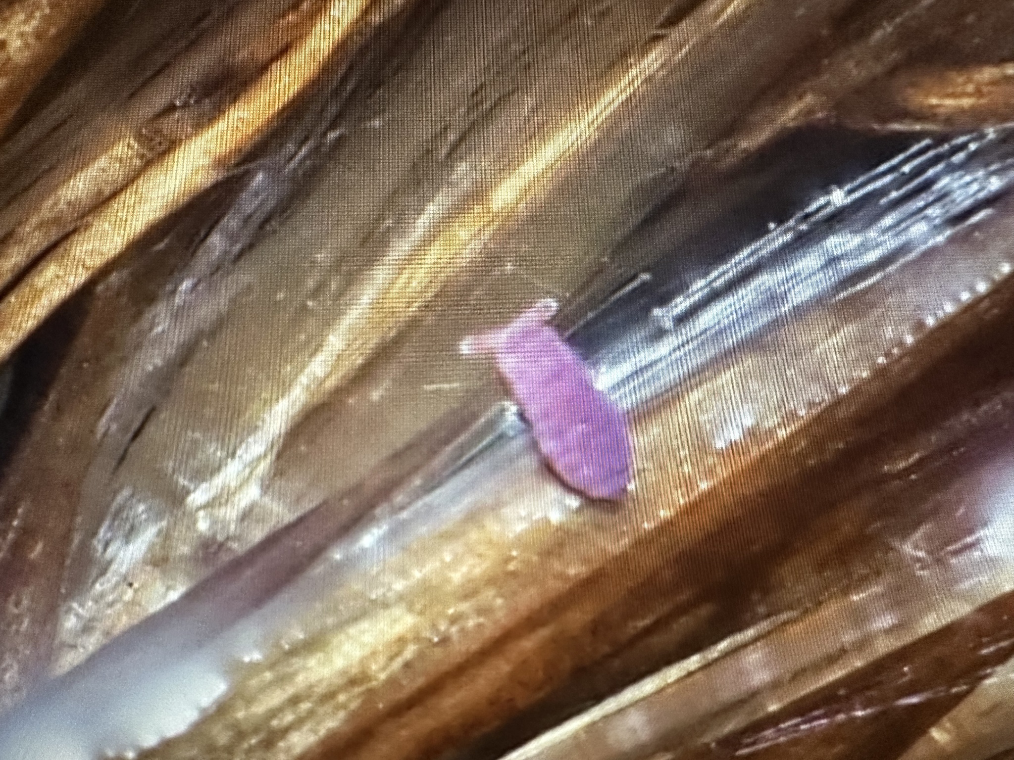 Brachystomella parvula (Schäffer, 1896)