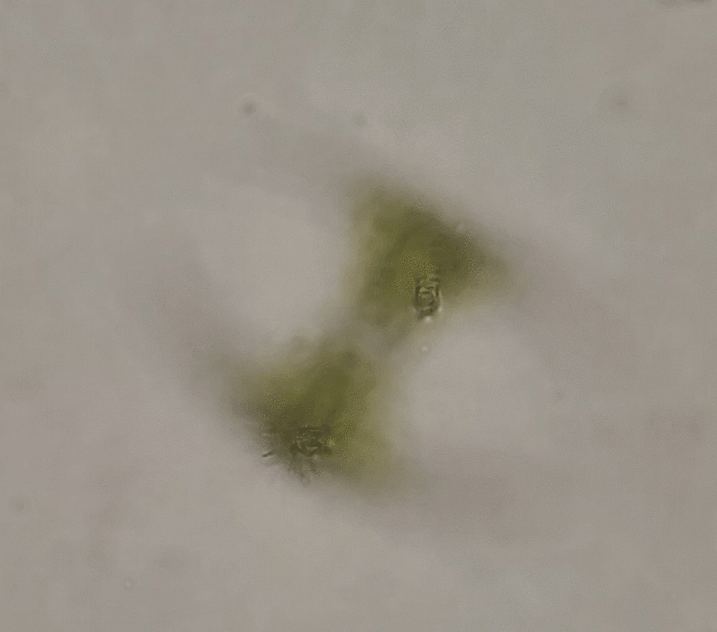 Staurastrum pseudosebaldi from priestdale qld 4127 australia on