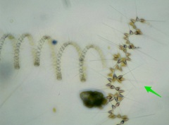 Asterionellopsis glacialis