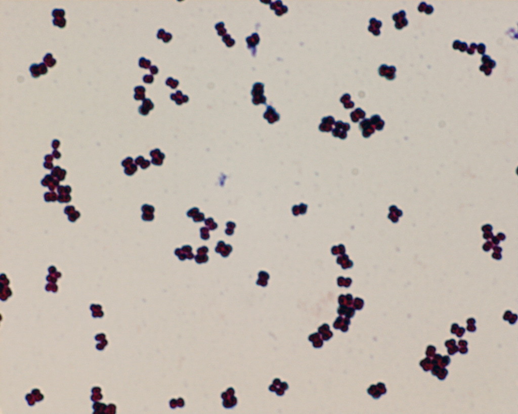 Protococcusa Under Microscope Micrococcus luteus from University Park, State College, PA, USA on ...