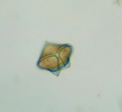 Protoperidinium