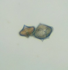 Protoperidinium