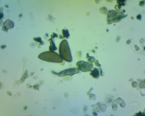Daldinia (Photo 11 of 14)