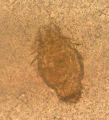 Macrotrachela multispinosa crassispinosa
