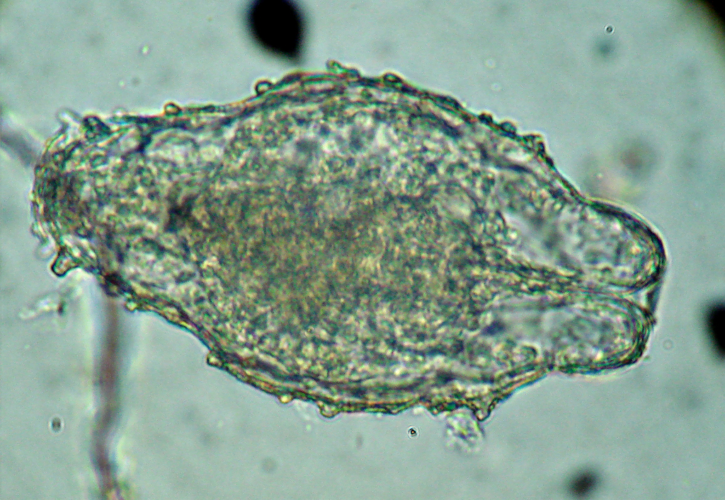 Macrotrachela papillosa