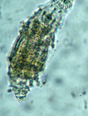 Macrotrachela papillosa