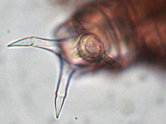 Rotaria tardigrada