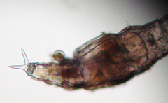 Rotaria tardigrada