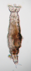 Rotaria tardigrada