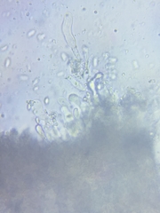 Resinomycena rhododendri
