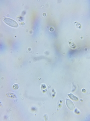 Resinomycena rhododendri