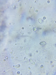 Resinomycena rhododendri