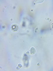Resinomycena rhododendri