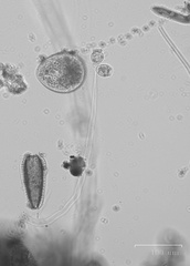 Vorticella