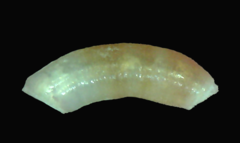 Caecum