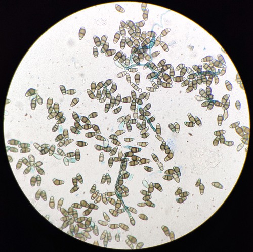 Curvularia lunata observed 2020-02-17