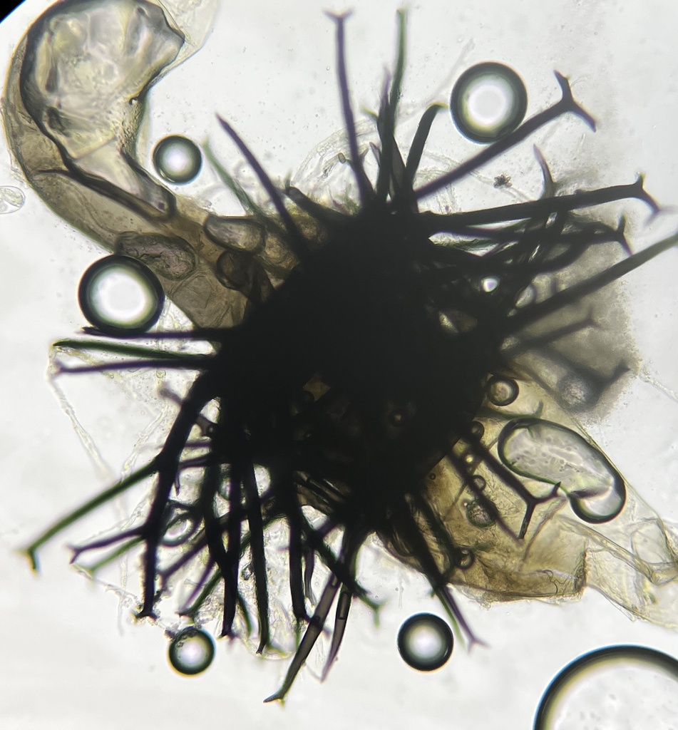Dichotomopilus