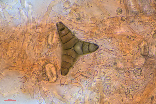 Asterosporium asterospermum observed 2025-02-12