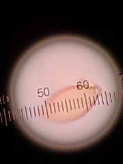 Botryobasidium conspersum