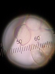 Botryobasidium conspersum