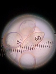 Botryobasidium conspersum