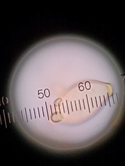 Botryobasidium conspersum