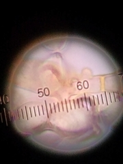 Botryobasidium conspersum