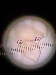 Botryobasidium conspersum