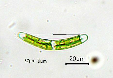 Closterium pusillum