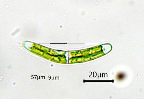 Closterium pusillum
