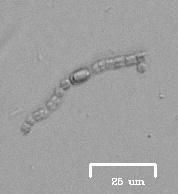 Anabaena