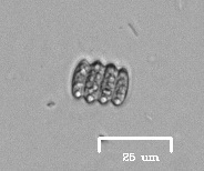 Scenedesmus